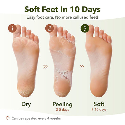 Baby Foot Shiny &amp; Soft Peeling Mask